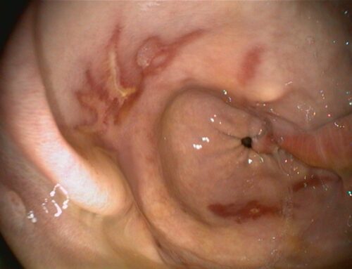 Studie zur Behandlung von Equine Gastric Glandular Disease mit intramuskulärem Omeprazol – zweiter Teil